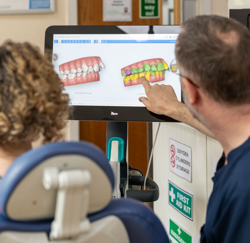 How does the iTero 3D scanner work?