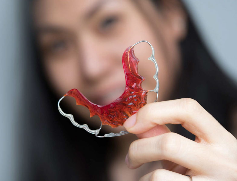 Functional appliance FAQs