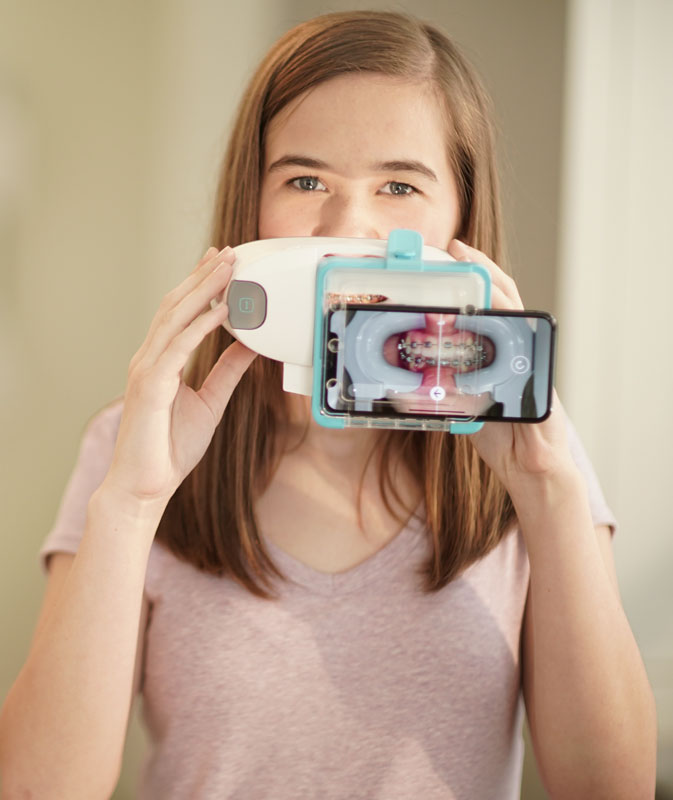 What is Dental Monitoring?