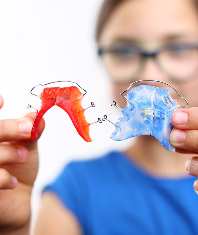 What are the types of retainers?