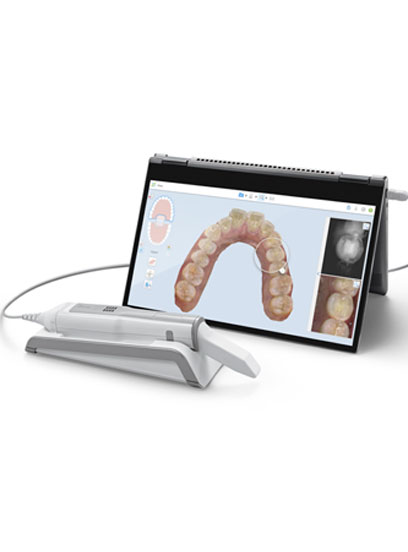 Dental Monitoring