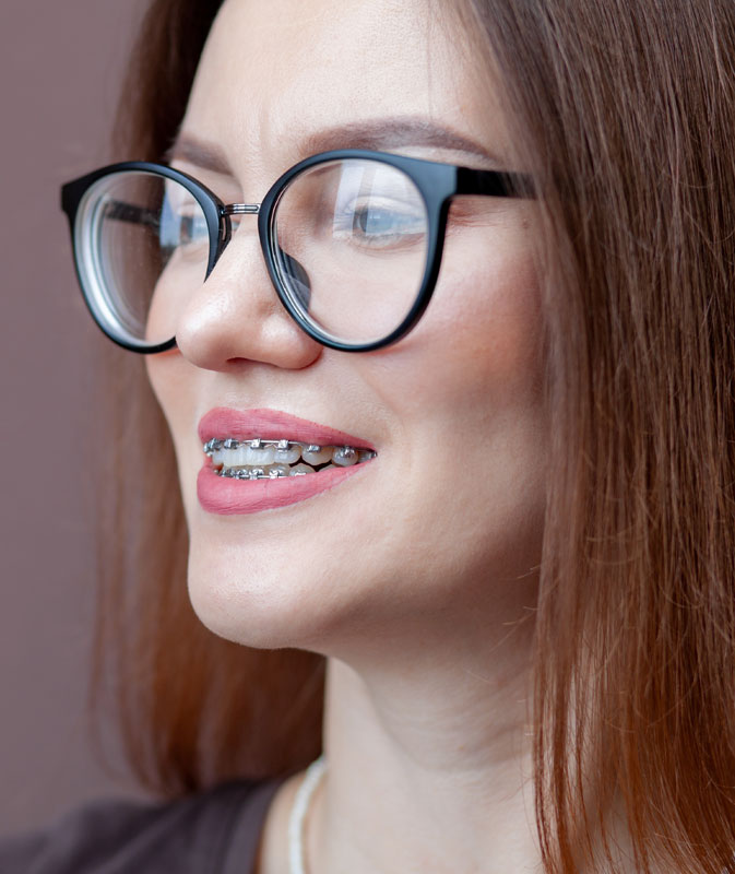 Types of braces we offer