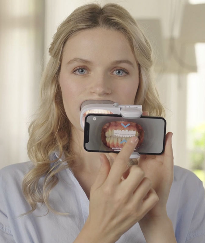 How does Dental Monitoring work?